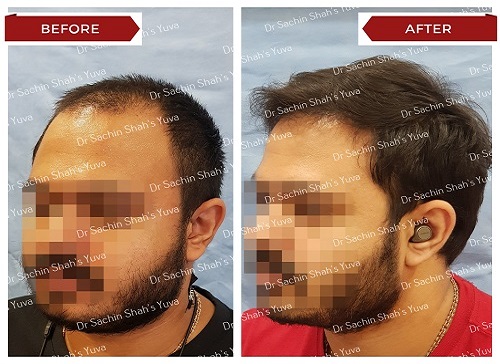 Hair 2 hair-2