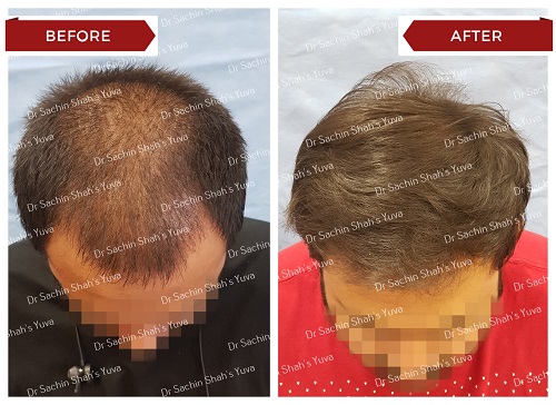 Hair 4 hair-4