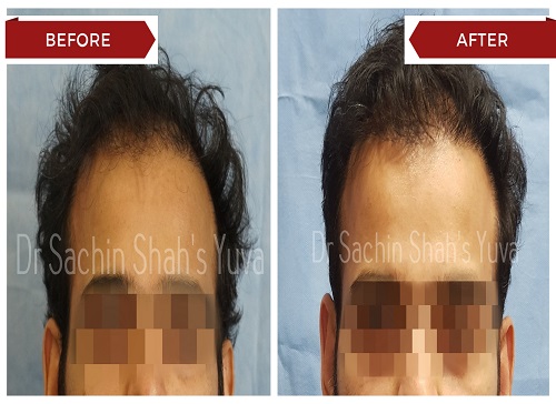 Hair 5 hair-5