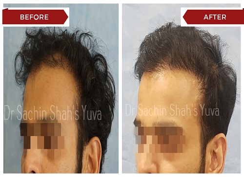 Hair 6 hair-6