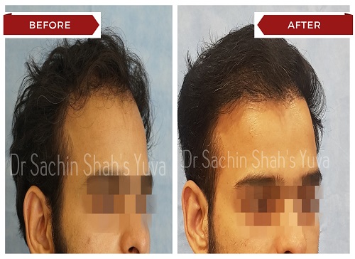 Hair 7 hair-7