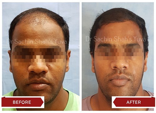 Hair 8 hair-8